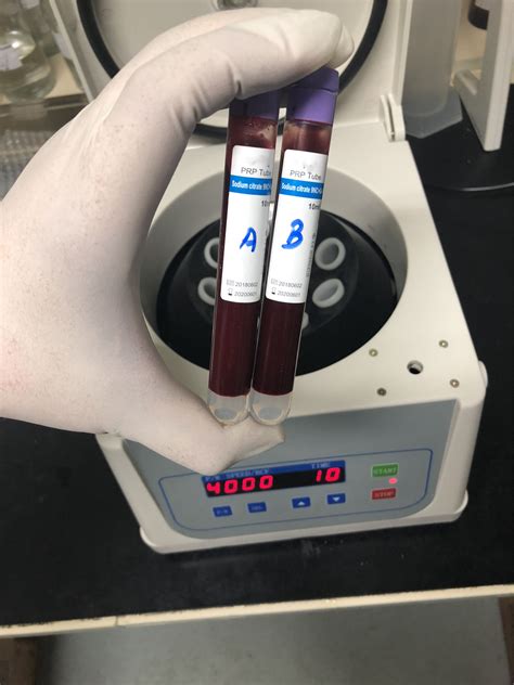 prp kits with free centrifuge